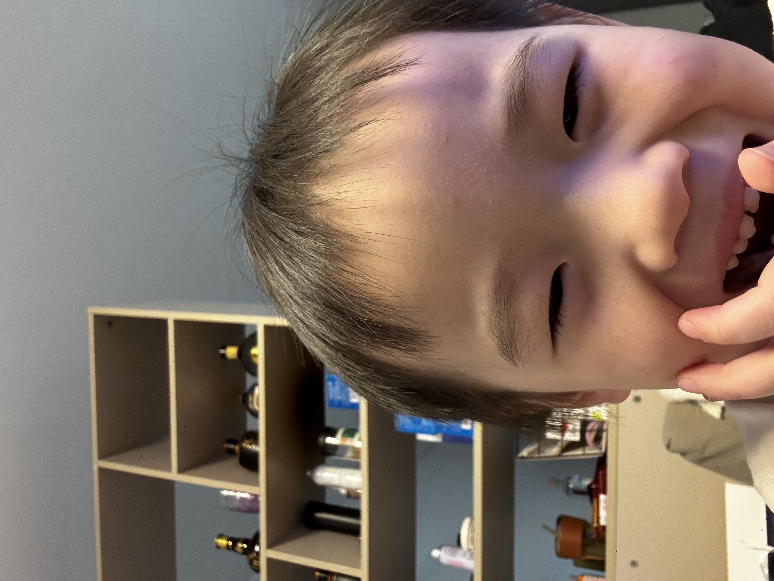 湿吻